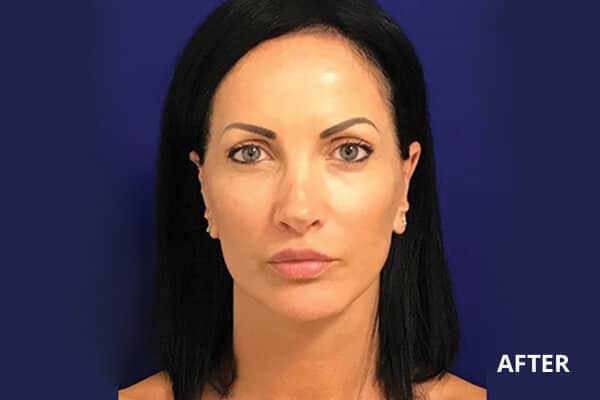 Dr. Madnani - Facial Plastic Surgery NYC Dr. Madnani - Facial Plastic Surgery NYC