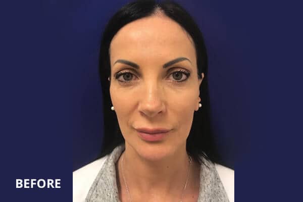 Dr. Madnani - Facial Plastic Surgery NYC Dr. Madnani - Facial Plastic Surgery NYC