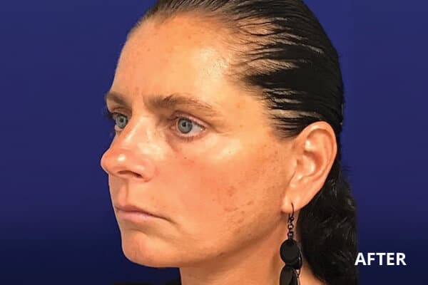 Dr. Madnani - Facial Plastic Surgery NYC Dr. Madnani - Facial Plastic Surgery NYC