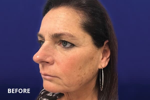 Dr. Madnani - Facial Plastic Surgery NYC Dr. Madnani - Facial Plastic Surgery NYC