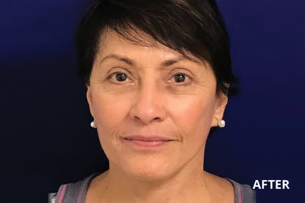 Dr. Madnani - Facial Plastic Surgery NYC Dr. Madnani - Facial Plastic Surgery NYC