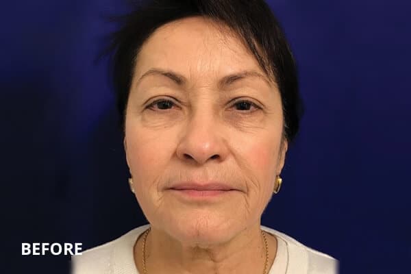 Dr. Madnani - Facial Plastic Surgery NYC Dr. Madnani - Facial Plastic Surgery NYC