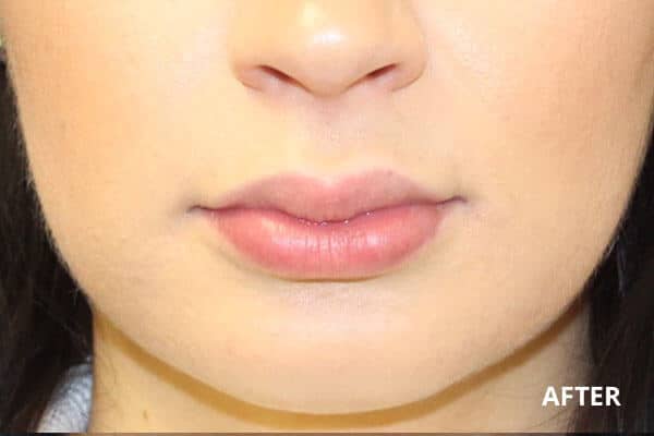 Dr. Madnani - Facial Plastic Surgery NYC Dr. Madnani - Facial Plastic Surgery NYC