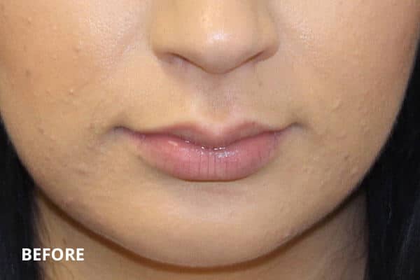 Dr. Madnani - Facial Plastic Surgery NYC Dr. Madnani - Facial Plastic Surgery NYC