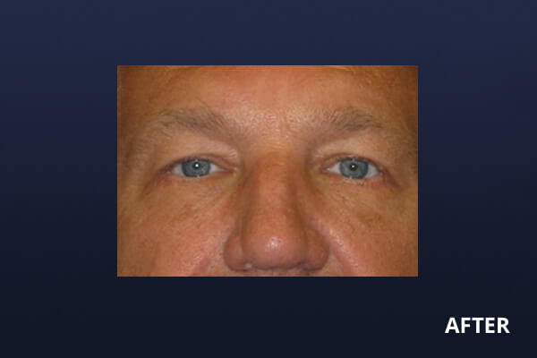 Gentlemen's Services Before and After Pictures Long Island & Manhattan, NY Gentlemen's Services Before and After Pictures Long Island & Manhattan, NY