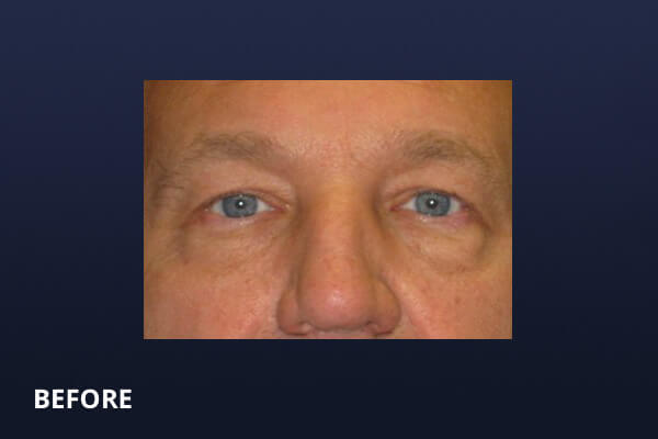 Gentlemen's Services Before and After Pictures Long Island & Manhattan, NY Gentlemen's Services Before and After Pictures Long Island & Manhattan, NY