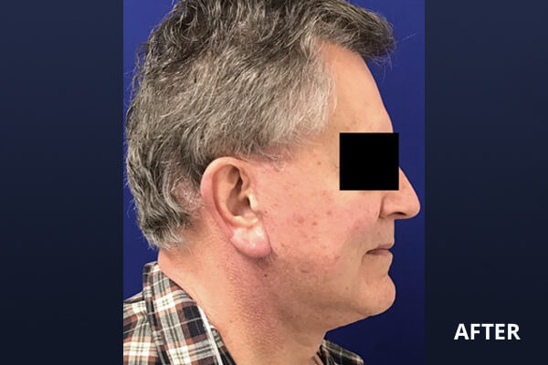 Gentlemen's Services Before and After Pictures Long Island & Manhattan, NY Gentlemen's Services Before and After Pictures Long Island & Manhattan, NY