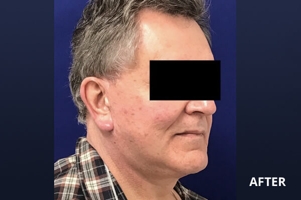 Gentlemen's Services Before and After Pictures Long Island & Manhattan, NY Gentlemen's Services Before and After Pictures Long Island & Manhattan, NY