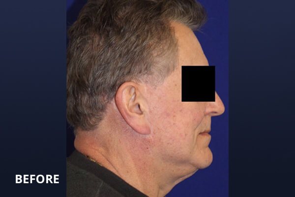 Gentlemen's Services Before and After Pictures Long Island & Manhattan, NY Gentlemen's Services Before and After Pictures Long Island & Manhattan, NY