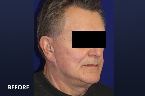 Gentlemen's Services Before and After Pictures Long Island & Manhattan, NY Gentlemen's Services Before and After Pictures Long Island & Manhattan, NY