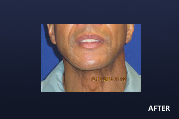 Gentlemen's Services Before and After Pictures Long Island & Manhattan, NY Gentlemen's Services Before and After Pictures Long Island & Manhattan, NY