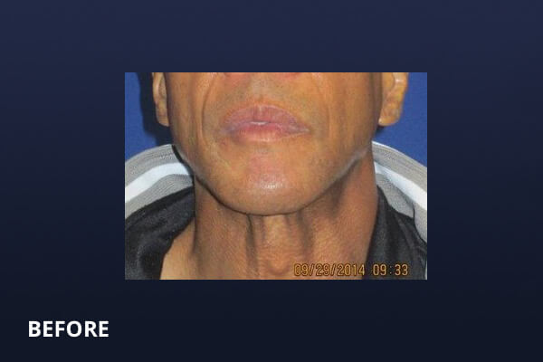Gentlemen's Services Before and After Pictures Long Island & Manhattan, NY Gentlemen's Services Before and After Pictures Long Island & Manhattan, NY