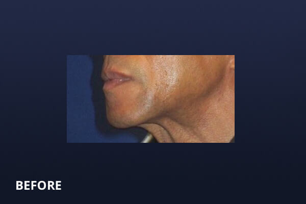 Gentlemen's Services Before and After Pictures Long Island & Manhattan, NY Gentlemen's Services Before and After Pictures Long Island & Manhattan, NY